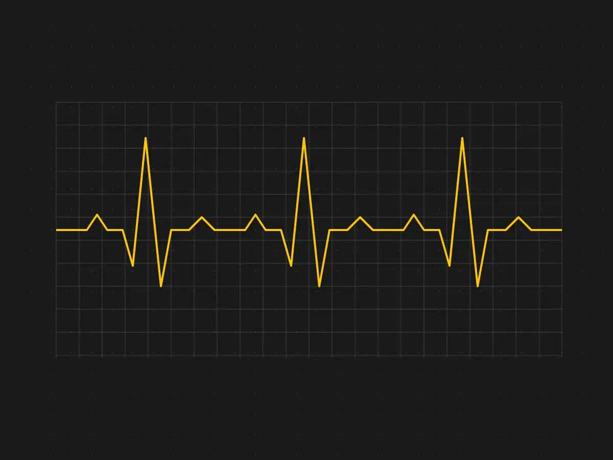 Electrocardiograma en amarillo sobre una cuadrícula